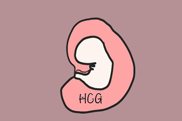 异位妊娠会让hcg升高