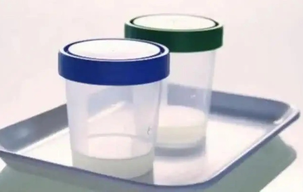 男方正常精子标准形态2%可以做二代试管吗？