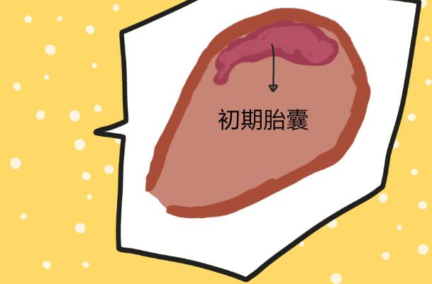 孕囊一般是呈椭圆形