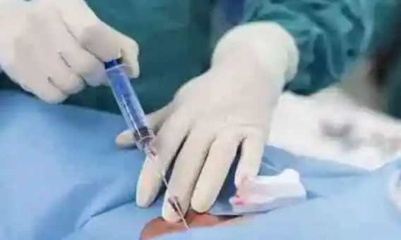 女性做取卵手术后需注意同房时间，临床建议禁欲两周为佳