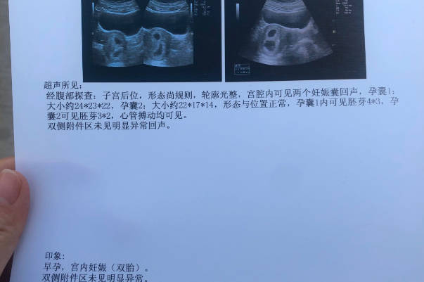 怀孕16周以后的B超检查可看性别