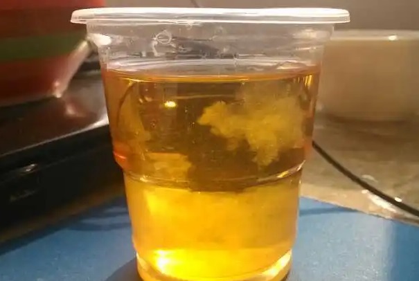 试管测尿一定要早上起来用晨尿测吗？