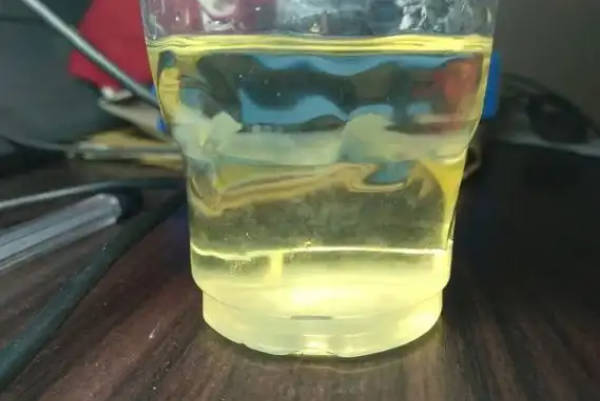 晨尿测宝宝性别并不准确