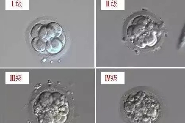 有姐妹能说说移植囊胚4ab和4bb哪个是儿子吗？