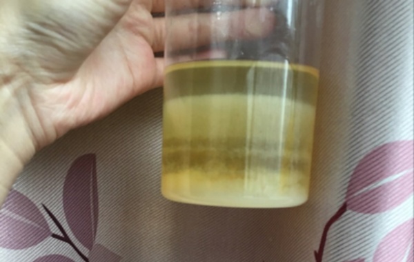 网传晨尿加75%酒精测男宝女宝有分层图参考可信吗？
