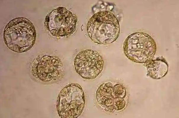 三代试管囊胚移植，技术突破背后的生命选择题