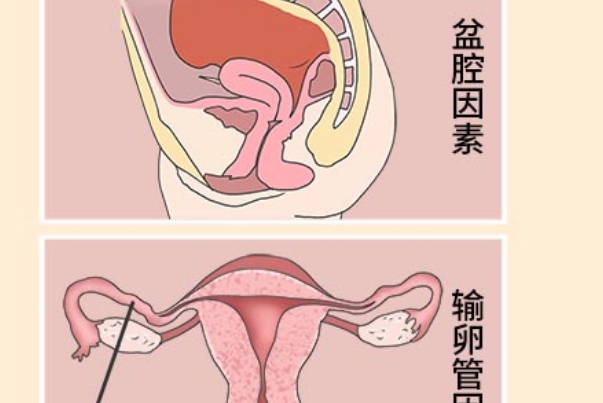 90后经常熬夜容易导致不孕不育