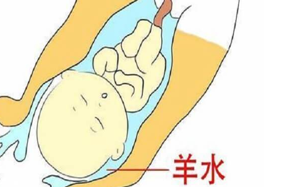 孕期羊水破了开宫口时间参考，内附多久会宫缩解读