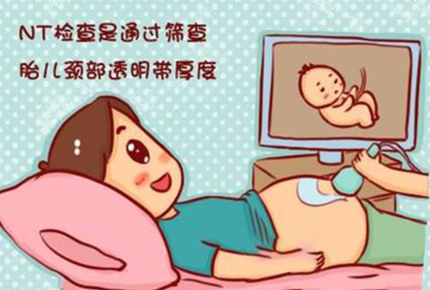 NT是孕期重要检查