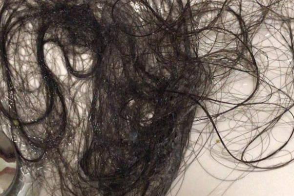 女性掉头发严重原因分析，4个改善方法可尝试