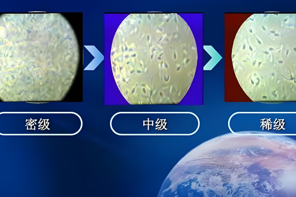 正常精子密度为≥15×10^6