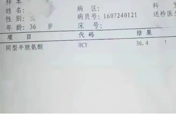 备孕检查hcy偏高，浓度含量过高容易导致胎停