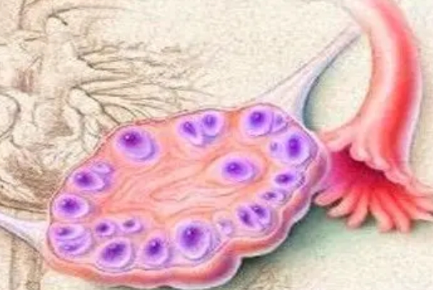 多囊科学调理可以提高怀孕几率