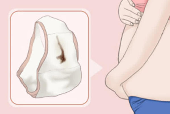 刚做完试管移植后第二天流出一团褐色的东西是胚胎掉了吗？