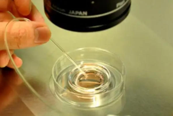 年龄会影响试管移植的胚胎个数