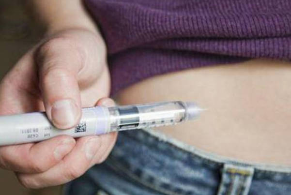 微刺激和拮抗剂促排卵方案详解，适用人群、时间、流程一览