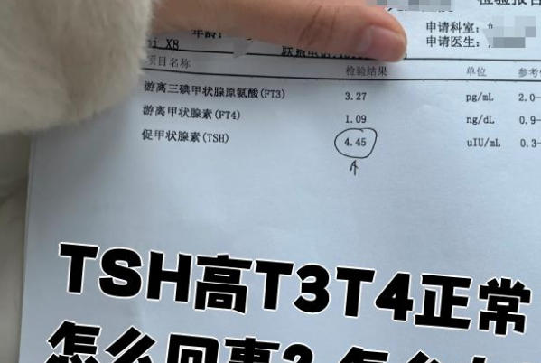 备孕时检查甲状腺高是什么原因，可能是自身免疫疾病作祟