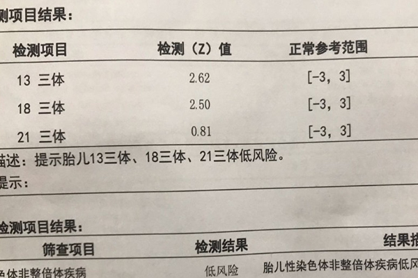 无创plus有必要做