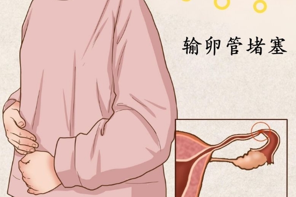 输卵管通而不畅还是有怀孕的几率