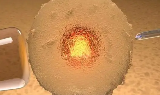 试管婴儿(IVF)是一种现代医学技术