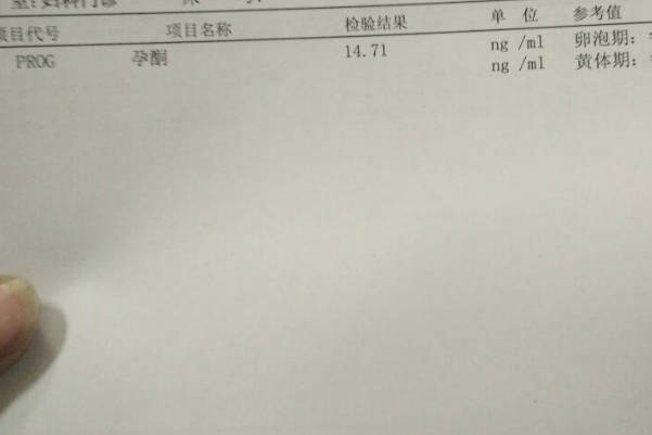 孕8周孕酮低住院保胎有用