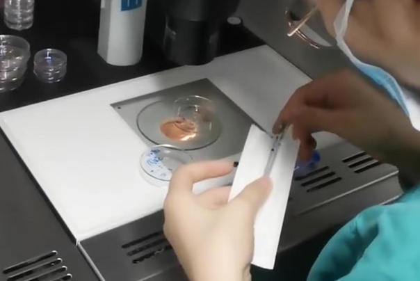 试管移植胚胎类型因人而异