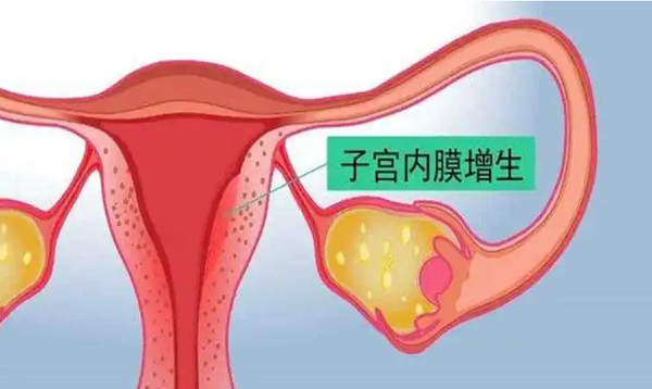 做三代试管的女性子宫内膜增生吃达英35能治愈吗?