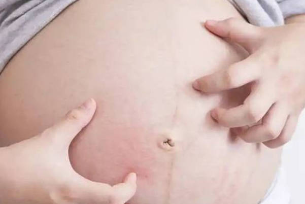 怀孕5个月后平躺看肚子中线怎么判断生男生女，附相关图解