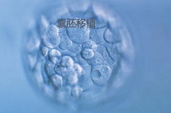 囊胚移植