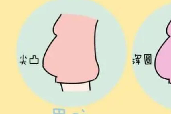 孕妇肚型尖凸是怀男孩