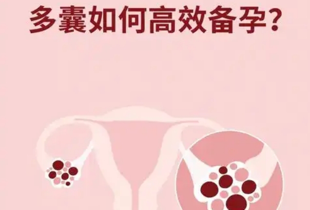 多囊怎么备孕才会怀上，科学调理受孕几率才会提升