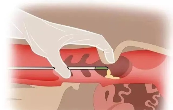 男性精子a加b才20精子活动能力较差