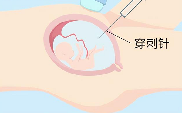 羊水穿刺不合格就不能要了必须打掉胎儿吗?