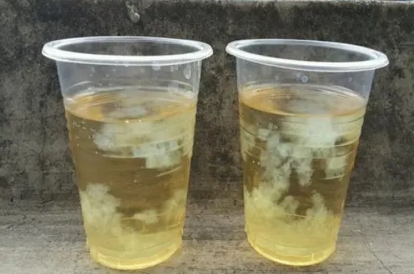 尿液稀释会导致试纸早上晚上结果不同