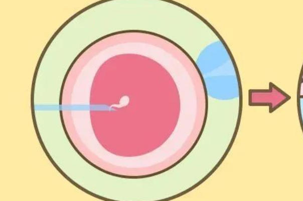 胚胎的类型会影响孕周的计算