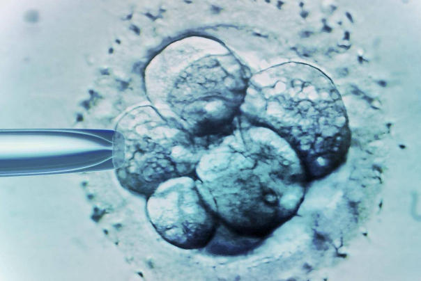 胚胎移植第四天没有症状是正常的