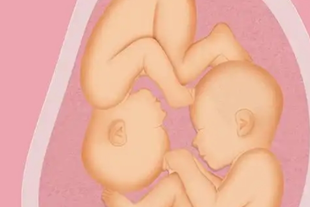 做试管生双胞胎胎儿的性别会不一样吗？