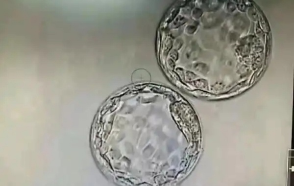 3ab和3bb囊胚细胞数目多且排列紧密