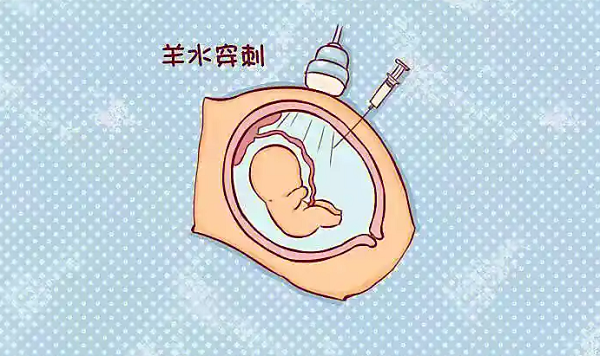 三代试管双胞胎需要做羊水穿刺吗?