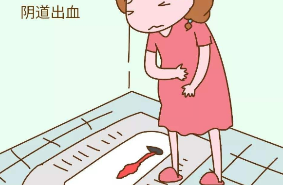 少量的阴道出血不会影响到妊娠结局