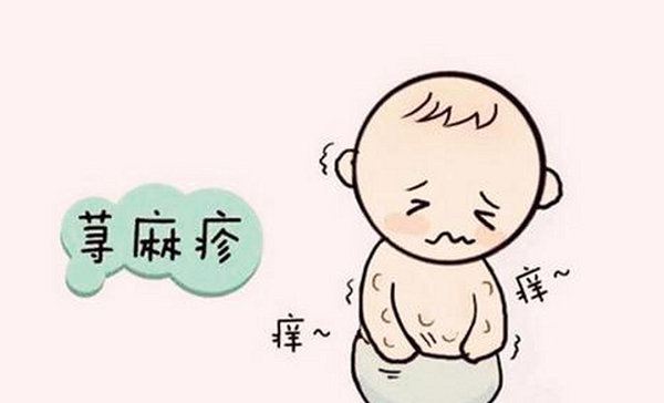 荨麻疹打卡介苗容易让病情加重