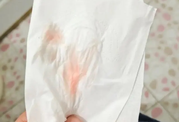 受精卵着床成功后正常阴道出血的图片是怎样的？