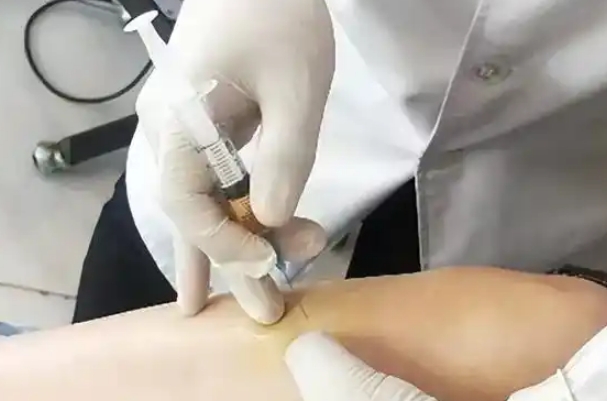 促排卵针可以促进卵泡的发育