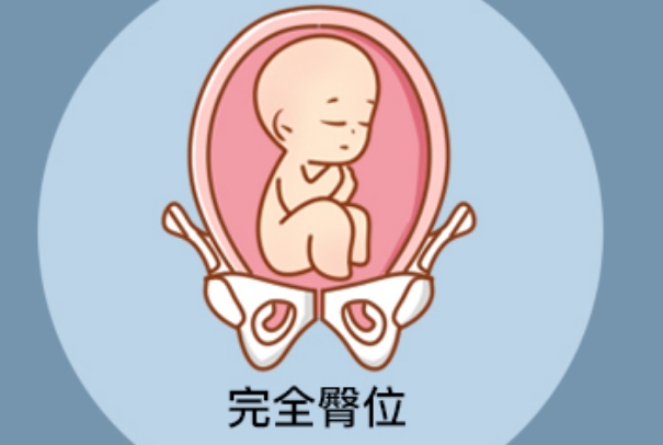 子宫环境异常会导致胎儿臀位