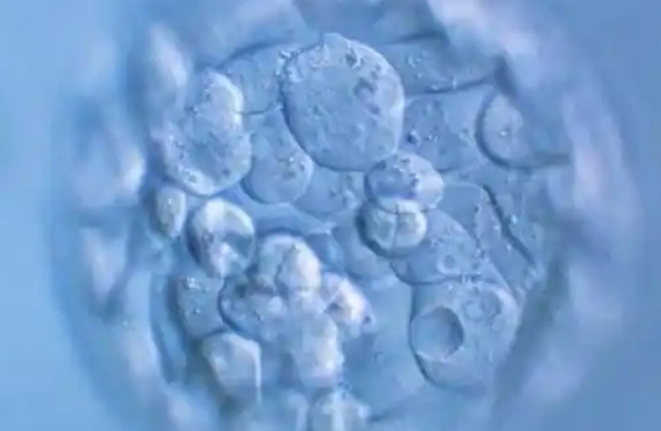 胚胎的质量会影响存活率