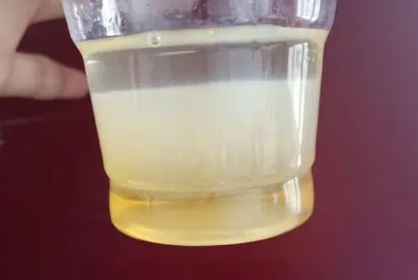 有宝妈能分享一下酒精加晨尿测是男是女的准确率吗？