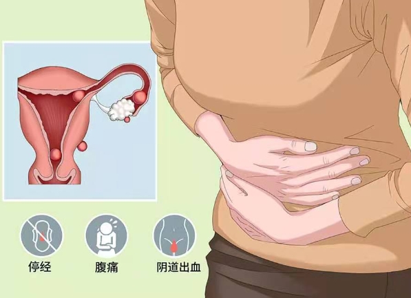 孕期腹痛可能是宫外孕