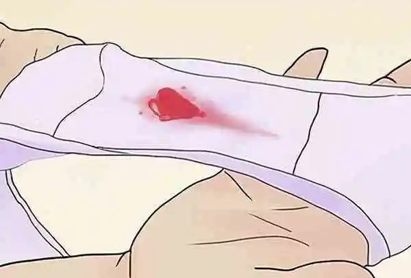 达必佳是降调药物