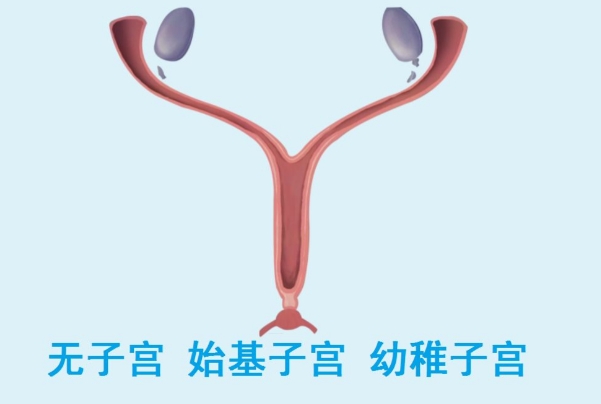 幼稚子宫有可能可以做试管