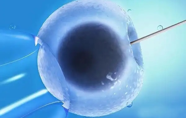 37岁女性有4次不良孕史可以做三代试管吗？